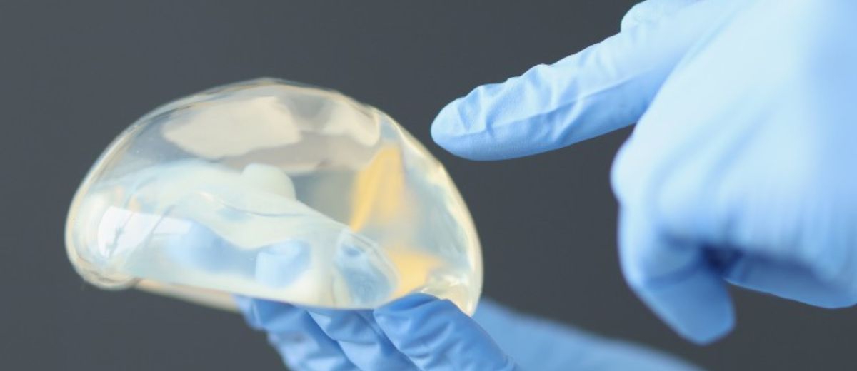 醫材生物相容性測試,你準備好了嗎?