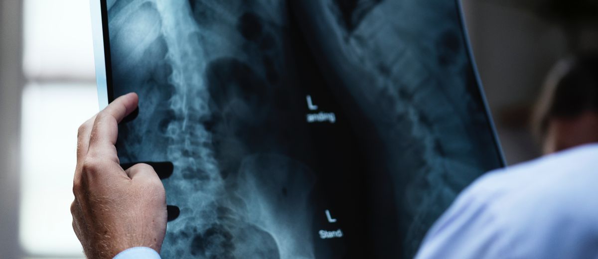 【醫材產業大數據】AI 醫療器材大爆發，骨科影像工具快速成長