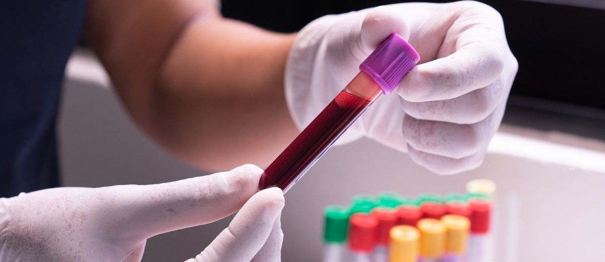 【體外診斷IVDR過渡期】您的IVD醫療器材準備好了嗎？SGS與您一起關注歐盟IVDR過渡期