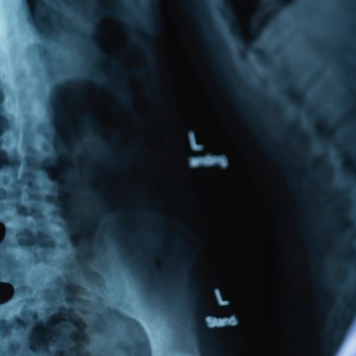 【醫材產業大數據】AI 醫療器材大爆發，骨科影像工具快速成長