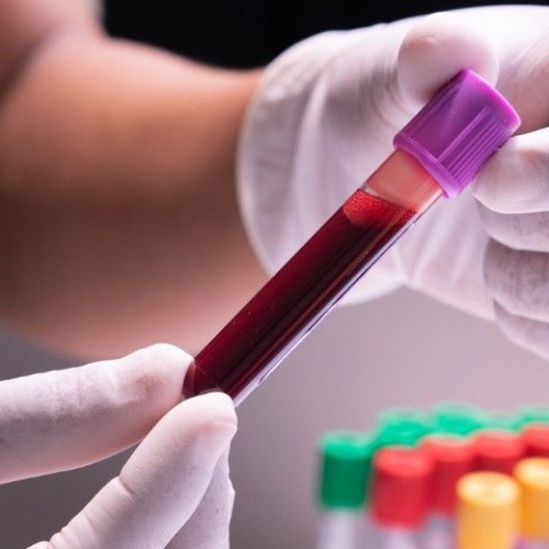 【體外診斷IVDR過渡期】您的IVD醫療器材準備好了嗎？SGS與您一起關注歐盟IVDR過渡期